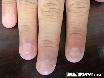 剪指甲、挖耳屎，这些日常小动作竟隐藏大危害！ - 吴忠生活资讯 - 吴忠28生活网 wuzhong.28life.net